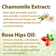 Load image into Gallery viewer, Natural Moisturizing Cream – Aloe Vera and Shea Butter developed for Eczema Rosacea Psoriasis Rashes Redness and Cracked Itchy Skin Relief – Relieve Dry Skin Naturally (4 .oz Jar)